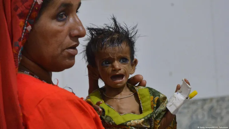 পাকিস্তানে প্রতি ১০ শিশুর ৪ জনই অপুষ্টির শিকার: গভীর হচ্ছে পুষ্টি সংকট